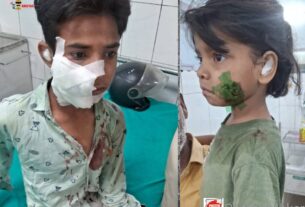 आवारा कुत्तों ने नोंचा जबड़ा, तीन में दो बच्चे एम्स रेफर
